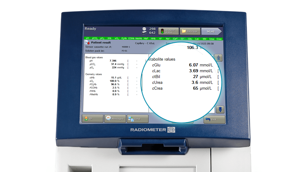 Kreatinine en ureum op de ABL90 FLEX PLUS-analyser